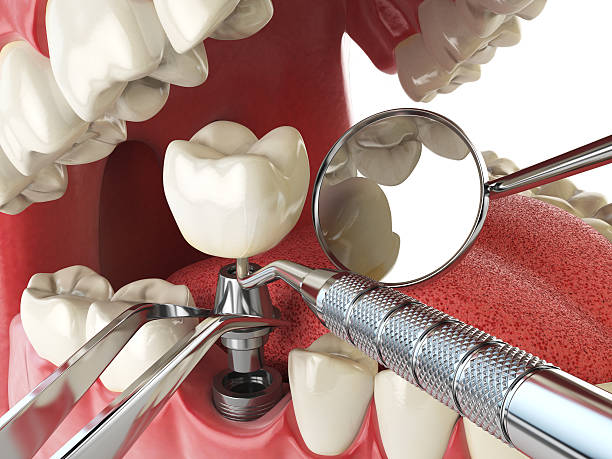 Professional Emergency Dental Service in LA